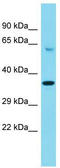 Chromosome 4 Open Reading Frame 17 antibody, TA331697, Origene, Western Blot image 