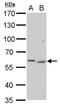 Galactosamine (N-Acetyl)-6-Sulfatase antibody, GTX110237, GeneTex, Western Blot image 