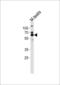 Zinc Finger And SCAN Domain Containing 5B antibody, LS-C160973, Lifespan Biosciences, Western Blot image 