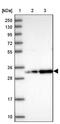 Coiled-Coil Domain Containing 127 antibody, NBP1-91756, Novus Biologicals, Western Blot image 