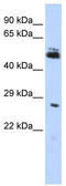 Ring Finger Protein 212 antibody, TA331533, Origene, Western Blot image 