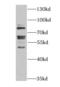 Fragile X Mental Retardation 1 antibody, FNab03172, FineTest, Western Blot image 