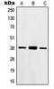 Homeobox B2 antibody, GTX55152, GeneTex, Western Blot image 