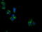 Peroxisomal Trans-2-Enoyl-CoA Reductase antibody, LS-C115791, Lifespan Biosciences, Immunofluorescence image 