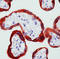 ABL Proto-Oncogene 1, Non-Receptor Tyrosine Kinase antibody, LS-C88555, Lifespan Biosciences, Immunohistochemistry paraffin image 