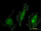 Serine/threonine-protein kinase N2 antibody, LS-C197990, Lifespan Biosciences, Immunofluorescence image 