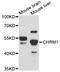 Acetylcholine Receptor antibody, A11829, ABclonal Technology, Western Blot image 