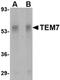 Plexin Domain Containing 1 antibody, orb74887, Biorbyt, Western Blot image 