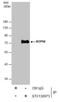 NOP56 Ribonucleoprotein antibody, GTX130973, GeneTex, Immunoprecipitation image 