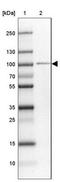 Zinc Finger Protein 281 antibody, NBP2-13564, Novus Biologicals, Western Blot image 