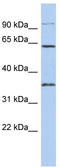 Family With Sequence Similarity 71 Member B antibody, TA340264, Origene, Western Blot image 