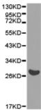 Eukaryotic translation initiation factor 6 antibody, TA324259, Origene, Western Blot image 
