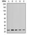 Protein Phosphatase 3 Regulatory Subunit B, Beta antibody, abx142166, Abbexa, Western Blot image 
