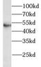 Leukocyte Immunoglobulin Like Receptor A2 antibody, FNab04775, FineTest, Western Blot image 