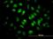 Scaffold Attachment Factor B antibody, H00006294-M04, Novus Biologicals, Immunofluorescence image 