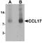 C-C Motif Chemokine Ligand 17 antibody, LS-C201050, Lifespan Biosciences, Western Blot image 