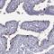 Stomatin Like 3 antibody, NBP2-62610, Novus Biologicals, Immunohistochemistry paraffin image 