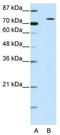 Histone acetyltransferase MYST2 antibody, TA331195, Origene, Western Blot image 