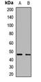 Arylacetamide Deacetylase antibody, orb411742, Biorbyt, Western Blot image 
