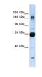 Collagen Type XI Alpha 2 Chain antibody, NBP1-59276, Novus Biologicals, Western Blot image 