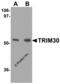Tripartite motif-containing protein 30 antibody, 4747, ProSci Inc, Western Blot image 