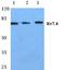 Potassium voltage-gated channel subfamily KQT member 4 antibody, A03659-2, Boster Biological Technology, Western Blot image 