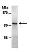 Catenin Delta 1 antibody, orb66808, Biorbyt, Western Blot image 