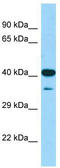 Cytosolic Iron-Sulfur Assembly Component 1 antibody, TA343486, Origene, Western Blot image 