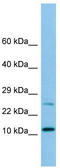 BLP antibody, TA338096, Origene, Western Blot image 