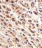 Dihydrofolate Reductase antibody, MBS9212252, MyBioSource, Immunohistochemistry paraffin image 