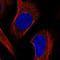 Outer dense fiber protein 2 antibody, HPA048841, Atlas Antibodies, Immunofluorescence image 