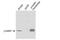 Cyclin-dependent kinase inhibitor 2A, isoforms 1/2/3 antibody, PA1-16661, Invitrogen Antibodies, Western Blot image 