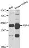 Aquaporin 4 antibody, A5665, ABclonal Technology, Western Blot image 