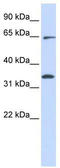 Mitochondrial Rho GTPase 1 antibody, TA335520, Origene, Western Blot image 