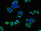 Calcium Voltage-Gated Channel Auxiliary Subunit Beta 4 antibody, orb47891, Biorbyt, Immunofluorescence image 
