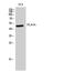 Phospholipase A1 member A antibody, A09234-2, Boster Biological Technology, Western Blot image 