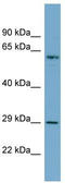 Basic Leucine Zipper ATF-Like Transcription Factor 2 antibody, TA342493, Origene, Western Blot image 