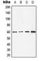 Cell Division Cycle 25C antibody, LS-C353935, Lifespan Biosciences, Western Blot image 