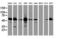 Epoxide Hydrolase 1 antibody, LS-C175278, Lifespan Biosciences, Western Blot image 