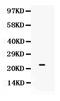 Secreted and transmembrane protein 1b antibody, PB9679, Boster Biological Technology, Western Blot image 