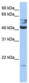Queuine TRNA-Ribosyltransferase Catalytic Subunit 1 antibody, TA346844, Origene, Western Blot image 