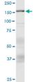 ASXL Transcriptional Regulator 1 antibody, H00171023-M05, Novus Biologicals, Western Blot image 