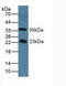 Nitric Oxide Synthase 1 Adaptor Protein antibody, LS-C373934, Lifespan Biosciences, Western Blot image 
