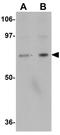 INSM Transcriptional Repressor 2 antibody, GTX85242, GeneTex, Western Blot image 