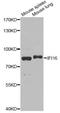 Gamma-interferon-inducible protein 16 antibody, LS-C749016, Lifespan Biosciences, Western Blot image 
