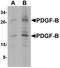 Platelet Derived Growth Factor Subunit B antibody, LS-C201038, Lifespan Biosciences, Western Blot image 