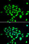 Dipeptidyl Peptidase 8 antibody, 22-710, ProSci, Immunofluorescence image 