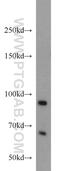 U4/U6 small nuclear ribonucleoprotein Prp3 antibody, 10106-1-AP, Proteintech Group, Western Blot image 