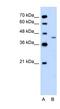 Dihydroorotate Dehydrogenase (Quinone) antibody, NBP1-59593, Novus Biologicals, Western Blot image 