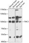 Transmembrane Channel Like 1 antibody, 14-539, ProSci, Western Blot image 